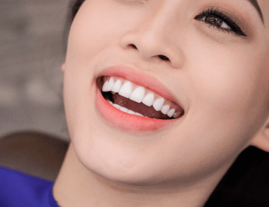 Bọc răng sứ thẩm mỹ