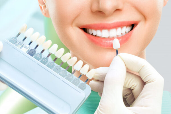 Trồng răng sứ thẩm mỹ là một phương pháp phục hình răng miệng
