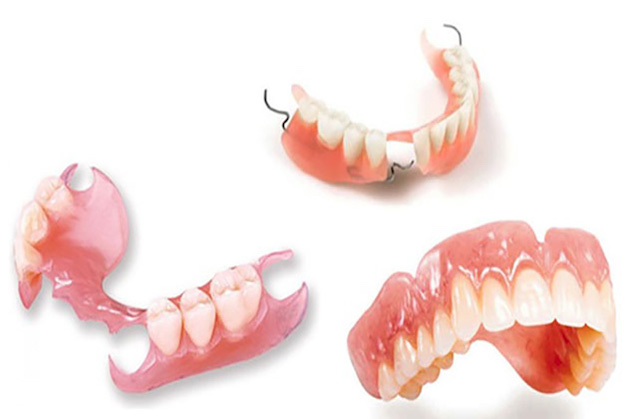 Dịch vụ trồng răng tháo lắp tại nha khoa Sài Gòn Mỹ Phước: nha khoa uy tín tại Bến Cát, Bình Dương